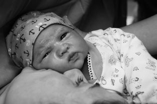 宝宝包皮发炎红肿怎么清洗用药？